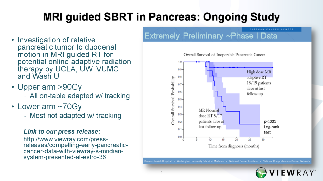 ViewRay核磁引導放療繫統治療不可切除的胰腺癌在本屆2017-ESTR0大會上大放異彩
